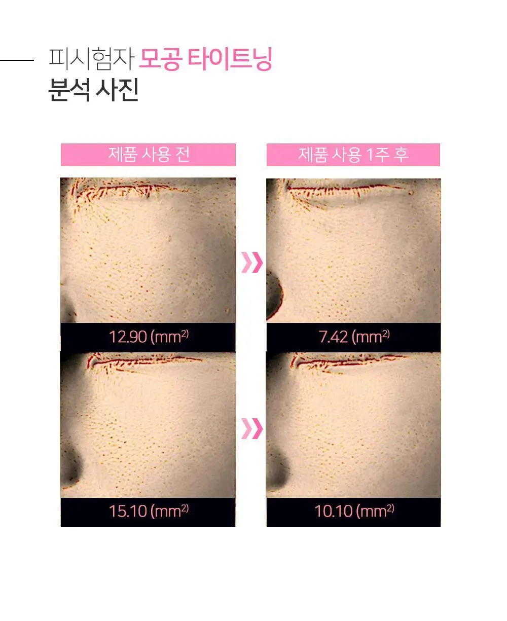 [숌.모든피부] 톤업 화이트 클렌징밤 1+1기획 상세페이지 42